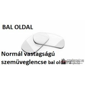 Normál műanyag szemüveglencse: BAL OLDAL