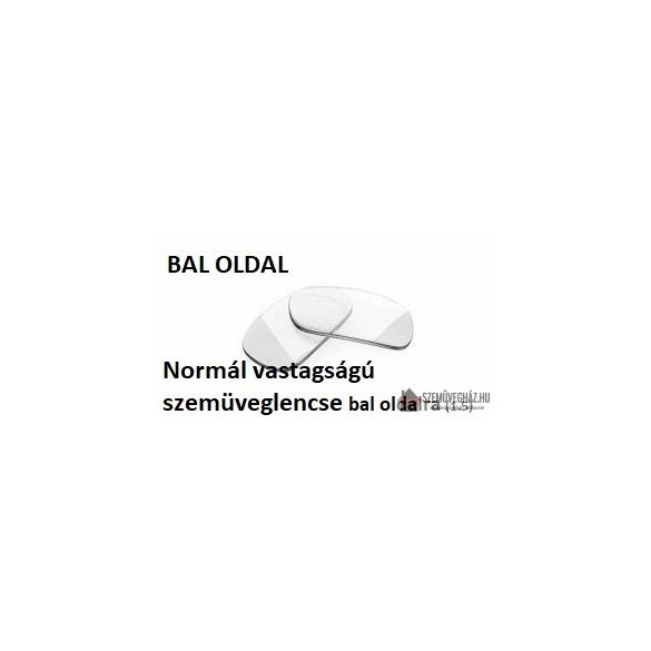 Normál műanyag szemüveglencse: BAL OLDAL